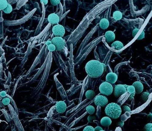 过敏原怎么去除小妙招 消除过敏源最好方法九游会J9 J9九游会(图3)