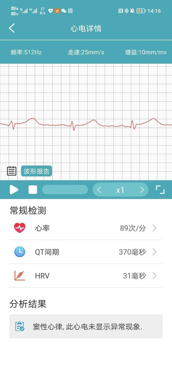 九游会J9 J9九游会2023智能手表推荐这三款智能手表绝对有一款适合你的！(图3)