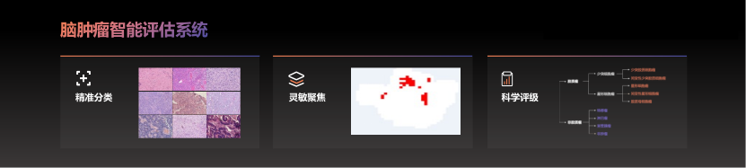 智影医疗什么是J9九游会 九游会J9智影医疗？的最新报道(图3)