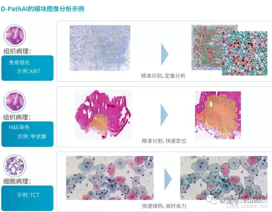 千亿规模的病理市场能否成为AI初创企业的新出口？J9九游会 九游会J9(图4)